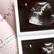 Illustration for article titled North Carolina House Overrides Veto To Pass Ultrasound Bill